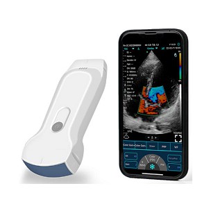 http://www.medisat.org/1053-thickbox_default/smart-wireless-scanner.jpg