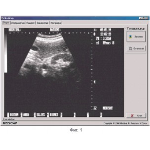 http://www.medisat.org/43-thickbox_default/software-medicap.jpg