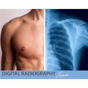 http://www.medisat.org/936-thickbox_default/x-ray.jpg